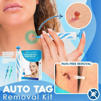 Auto micro skin tag remover
