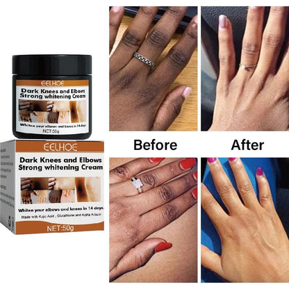Dark Knuckles Fast Whitening Cream