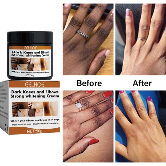 Dark Knuckles Fast Whitening Cream