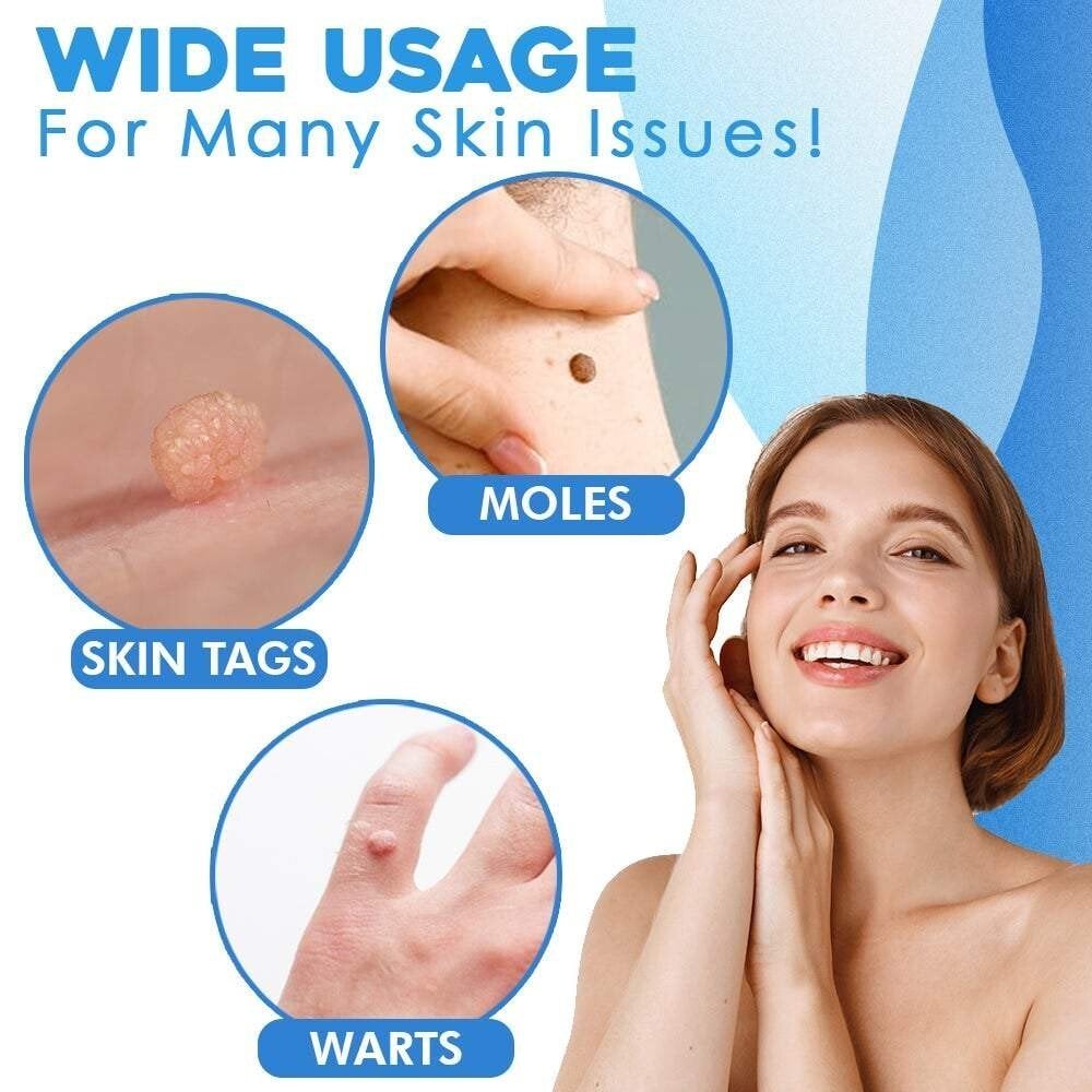 Auto micro skin tag remover