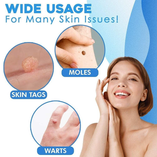 Auto micro skin tag remover