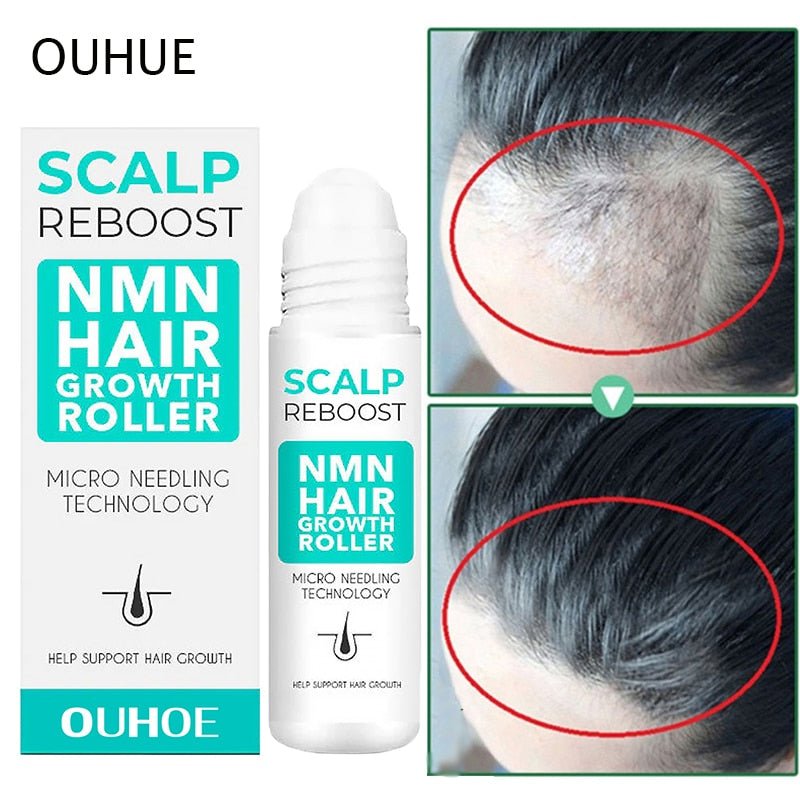 Rapid Hair Growth Serum Roller